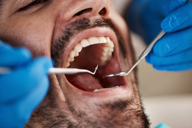 Best Orthodontic Emergency Dentist in Piednt, MO